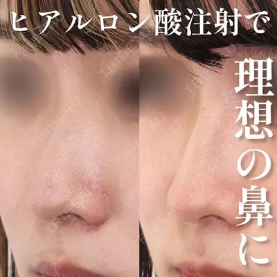 新宿TAクリニック 高田 泰宜医師の症例