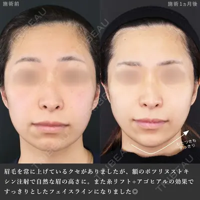 新宿TAクリニック 高田 泰宜医師の症例