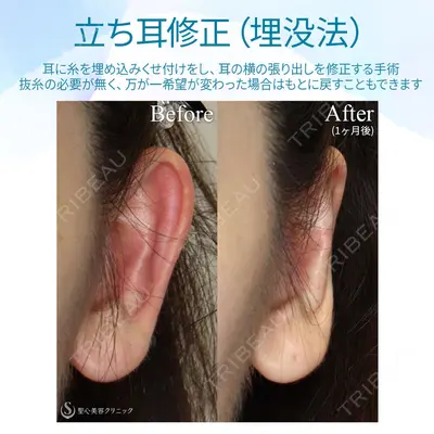 聖心美容クリニック 六本木院 菱田 健作医師の症例