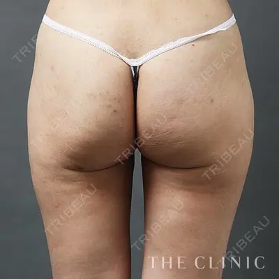 THE CLINIC（ザ・クリニック） 名古屋院の症例