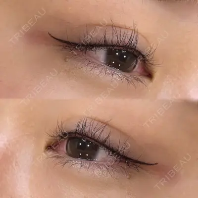 Tokyo Tensei Clinic 新宿院 斉藤美優医師の症例