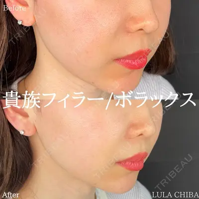 ルラ美容クリニック 池袋院 下川 洋輝医師の症例