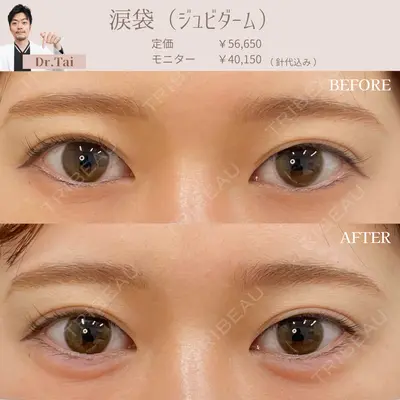 ルラ美容クリニック銀座院 山本 泰輔医師の症例