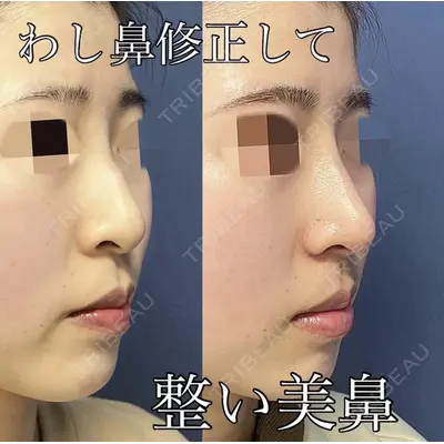 グローバルビューティークリニック 大阪院の症例