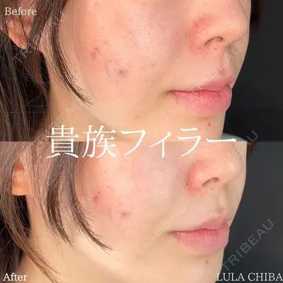 ルラ美容クリニック 池袋院 下川 洋輝医師の症例