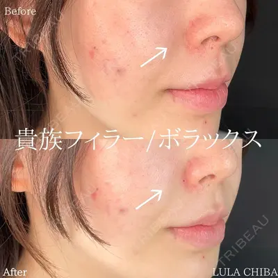 ルラ美容クリニック 池袋院 下川 洋輝医師の症例