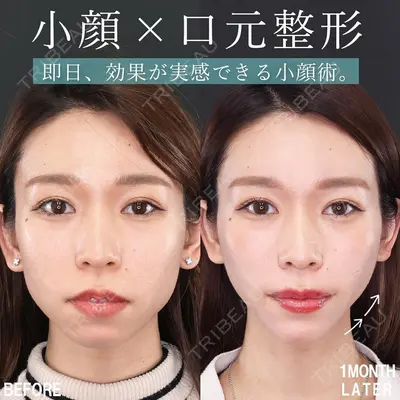 高崎TAクリニックの症例