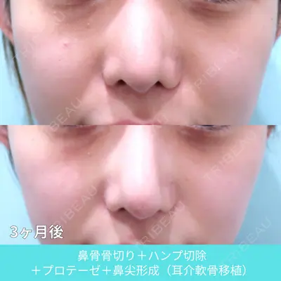 WOM CLINIC GINZA （ワム クリニック ギンザ） 佐々木 和司医師の症例