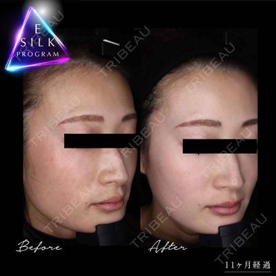 美容皮膚科エルムクリニック 福岡院の症例