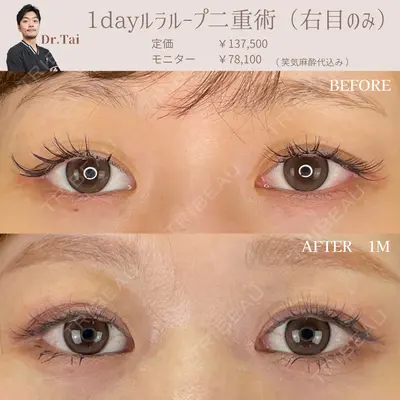 ルラ美容クリニック銀座院 山本 泰輔医師の症例