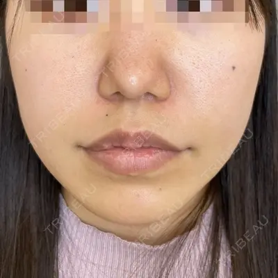 ルラ美容クリニック 渋谷本院 昼間 路子医師の症例