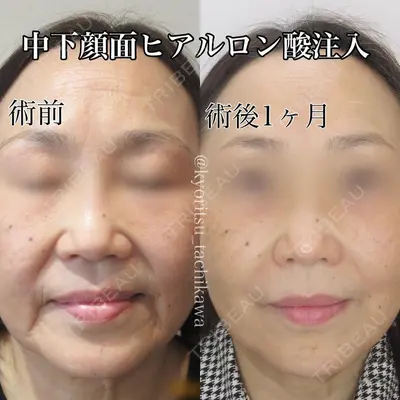 共立美容外科 大分院の症例