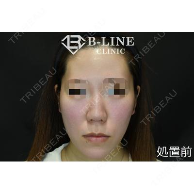 B-LINE CLINIC 池袋院の症例