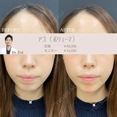 ルラ美容クリニック銀座院 山本 泰輔医師の症例