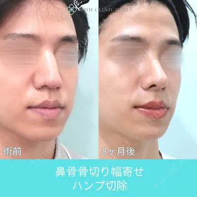 WOM CLINIC GINZA （ワム クリニック ギンザ） 佐々木 和司医師の症例