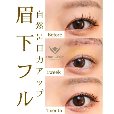 Otus Clinic 【オータスクリニック】 中 徳太郎医師の症例