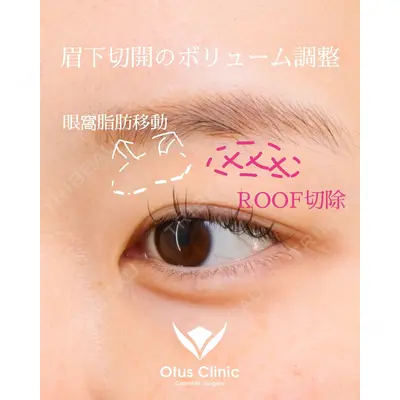 Otus Clinic 【オータスクリニック】 中 徳太郎医師の症例