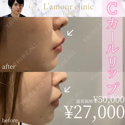 L‘amour clinic Tokyo【ラムールクリニック東京】 片岡 紘士医師の症例