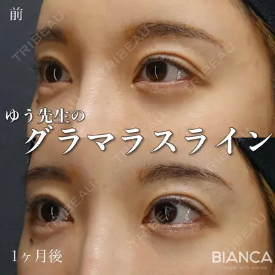 BIANCA表参道 大久保 由有医師の症例