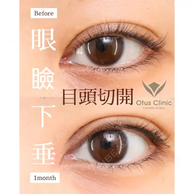 Otus Clinic 【オータスクリニック】 中 徳太郎医師の症例