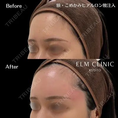 美容皮膚科エルムクリニック 京都院の症例