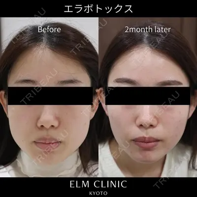 美容皮膚科エルムクリニック 京都院の症例