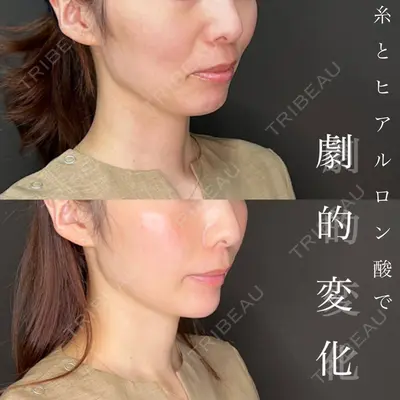 美容皮膚科エルムクリニック 神戸院 七里 阿寿美医師の症例