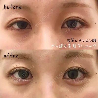 さっぽろ美容クリニックの症例