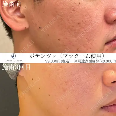 LOUIS CLINIC 二子玉川院【ルイクリニック】 小松 塁医師の症例