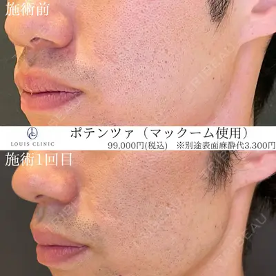 LOUIS CLINIC 二子玉川院【ルイクリニック】 小松 塁医師の症例
