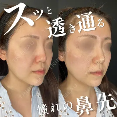 ルラ美容クリニック 池袋院 小海 元｜長期休暇につき指名不可医師の症例