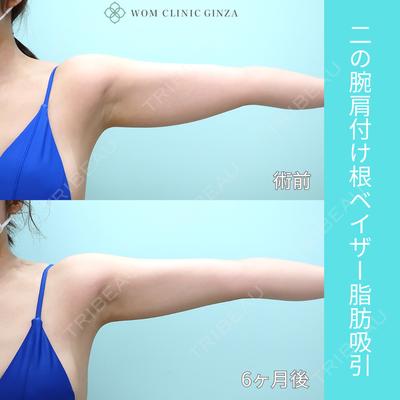 WOM CLINIC GINZA （ワム クリニック ギンザ） 佐々木 和司医師の症例