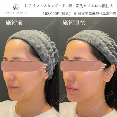 LOUIS CLINIC 二子玉川院【ルイクリニック】 小松 塁医師の症例