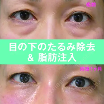 S.T styleクリニック 徳田 真紀子医師の症例