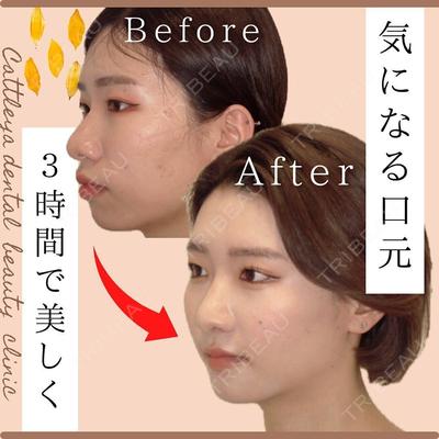 カトレア歯科・美容クリニック 辻 和志医師の症例