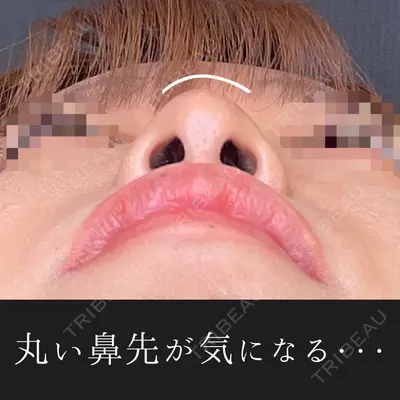 ルラ美容クリニック 渋谷本院 昼間 路子医師の症例