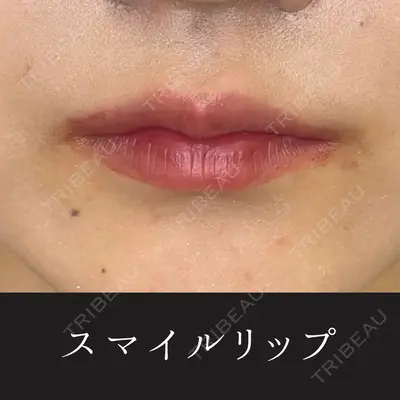 ルラ美容クリニック 渋谷本院 昼間 路子医師の症例