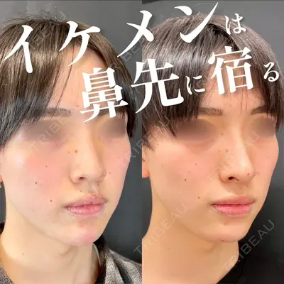 ルラ美容クリニック 池袋院 小海 元｜長期休暇につき指名不可医師の症例