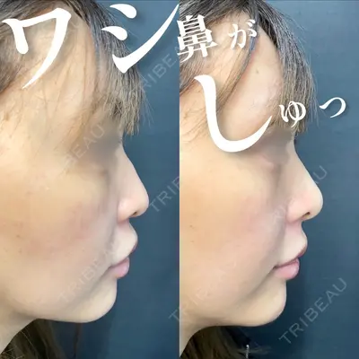 ルラ美容クリニック 池袋院 小海 元｜長期休暇につき指名不可医師の症例