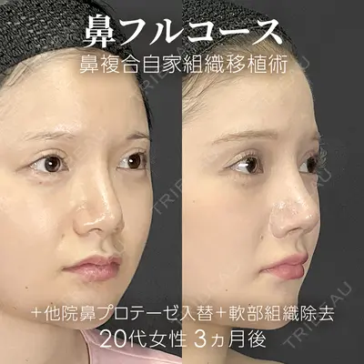ジョウクリニック 銀座院 重本　譲医師の症例