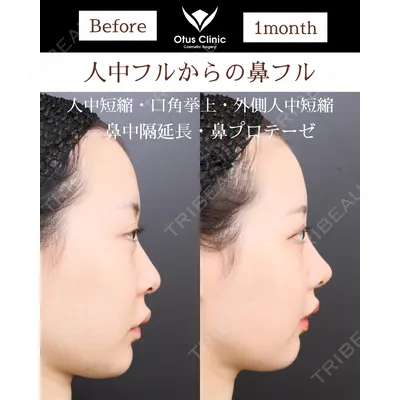 Otus Clinic 【オータスクリニック】 中 徳太郎医師の症例