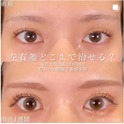 SOL CLINIC 向井 英子医師の症例