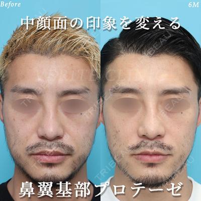 ヴェリテクリニック 銀座院 積山 真也医師の症例
