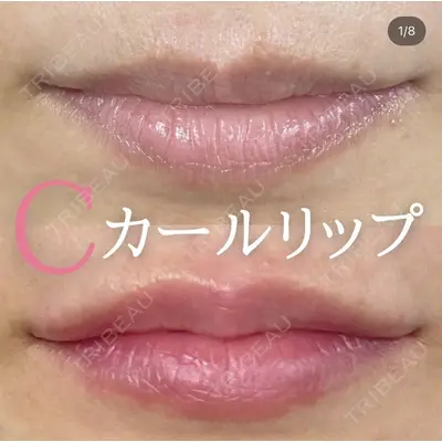 ルラ美容クリニック 広島院の症例