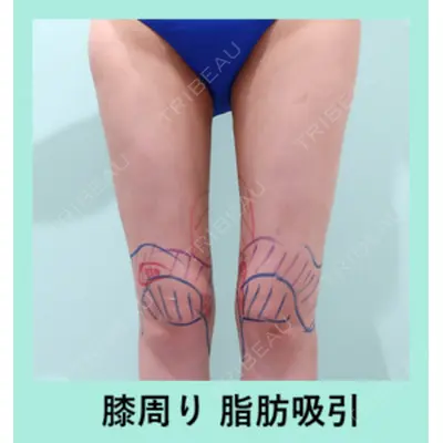 WOM CLINIC GINZA （ワム クリニック ギンザ） 佐々木 和司医師の症例