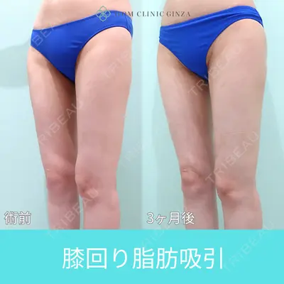 WOM CLINIC GINZA （ワム クリニック ギンザ） 佐々木 和司医師の症例