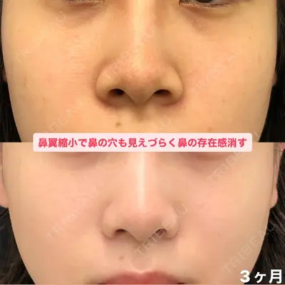 湘南美容クリニック 浜松院の症例
