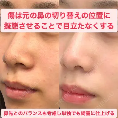 湘南美容クリニック 金山院の症例