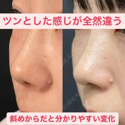 湘南美容クリニック 浜松院の症例