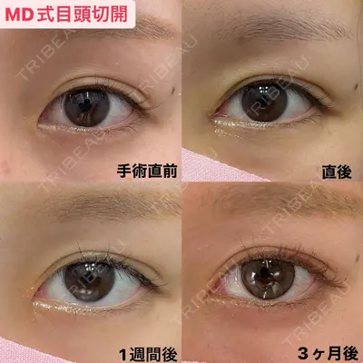 湘南美容クリニック 銀座院の症例